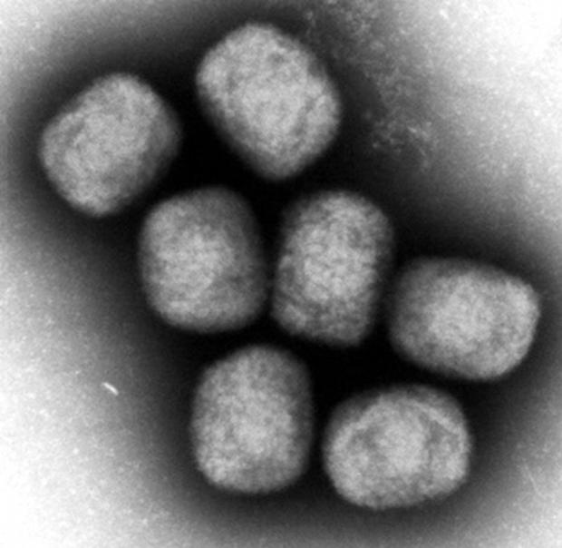 エムポックス（サル痘）感染の男性死亡　国内初、埼玉県の30代、エイズウイルス（HIV）に感染し、免疫不全状態だったという