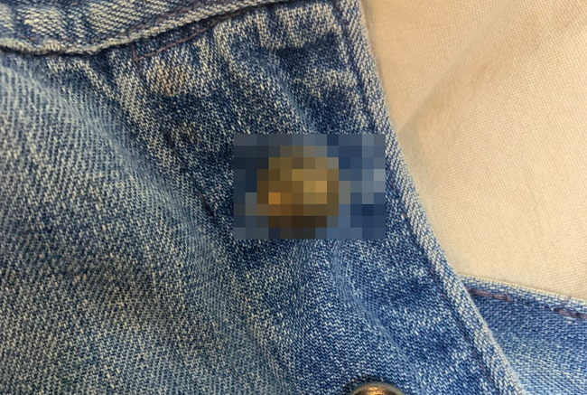 「メルカリで購入したデニムが届いた！けど何かがおかしい」ﾊﾟｼｬｯ → ボタンがとんでもない物に変えられていたｗｗｗｗｗ
