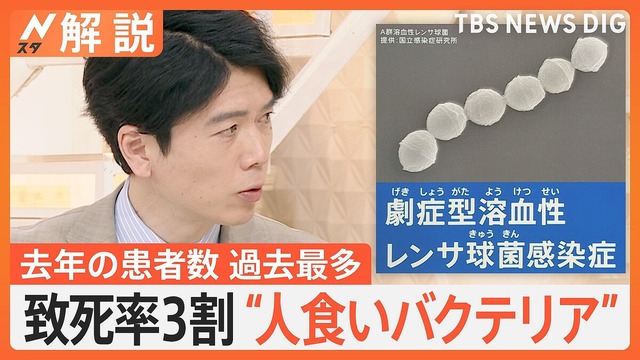 衛生的な日本でなぜか「人食いバクテリア」の感染が急増……感染すれば手足や臓器が壊死し致死率は30%