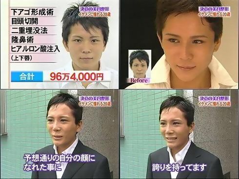 整形してはいけないみたいな風潮ってなんで？