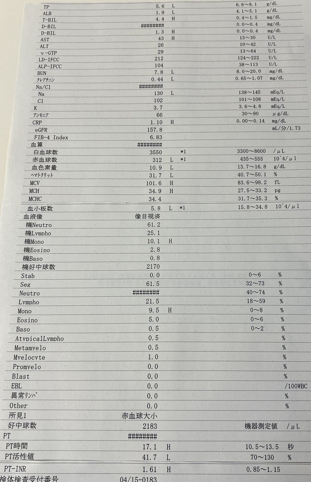 配信者の金バエさん、アルコール性肝硬変でアルブミン数値が異常値限界突破の1.9L、医者にもう死ぬと言われる