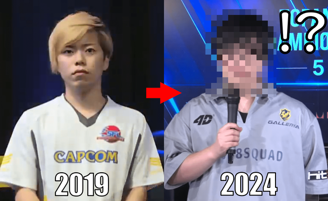 イケメンプロゲーマーさん、たった5年で変わり果てた姿になってしまう・・・