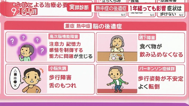 熱中症ガチでヤバかった　脳に後遺症が残るケースも