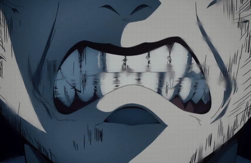 【マジ注意】なぜ虫歯を放置しちゃダメなの？　→　誰でも一発で恐ろしさが理解できる理由がこちら…お前ら、すぐ歯医者行け！！