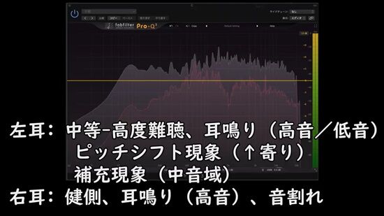 ボカロP「難聴の人にどう音楽が聴こえているか、健常者にも分かるよう再現しました」→キツすぎだろこれ・・・
