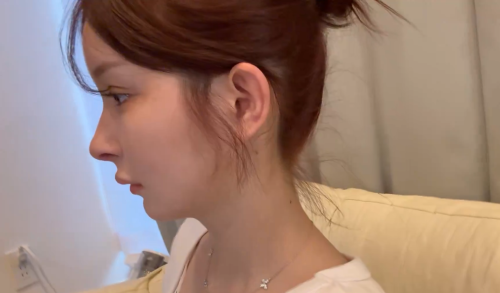 整形女子、とんでもない動画を公開してしまう・・・「首に◯◯したら大変なことになっちゃったの」