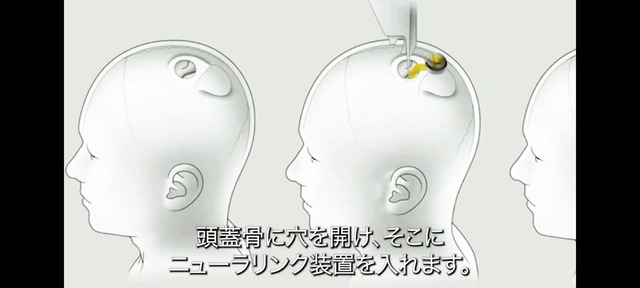イーロン・マスク「外国語勉強してた人達、無駄です！ｗ」   脳に言語を直接ダウンロードする時代へ
