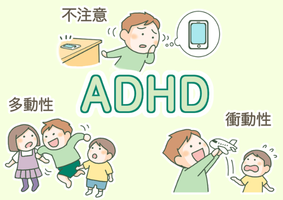 「ADHDにはアッパー系とダウナー系があって時と場合によって状態が変わる」←ネットで共感の嵐に