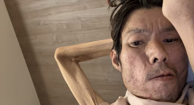 金バエさん、骨だけの状態になる。すまん、アルコールってドラックじゃないか？？？？