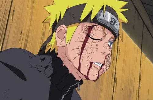 【地獄】中国人コスプレイヤーさん、中国で『NARUTO』コスプレをしたら「日本人の格好なんかしやがって！」とこん棒を持った地元年配男性から襲撃されてしまう……