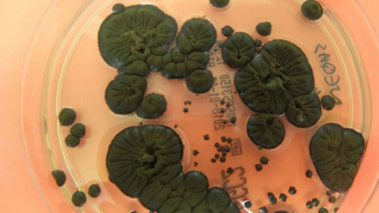 チェルノブイリで発見された放射線を食べる真菌、宇宙利用への実験