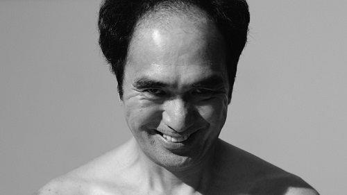 エガちゃん、あの病気だった事を初告白　あまりに壮絶な闘病生活が語られる…